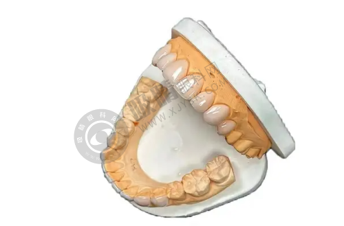 北京美呀植联口腔门诊部种植牙4980元起靠谱吗？3D导航微创技术+北大博士团队亲诊！