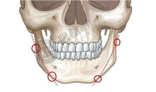 总结:多方考量,选对长沙取奥美定医院