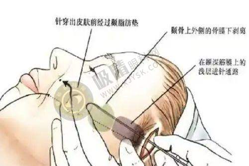 上海德媛医疗美容门诊部正规吗？精良技术设备助力