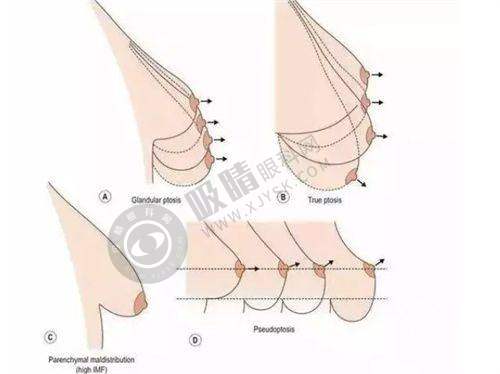 总结:舒敏之星可修复增厚角质层