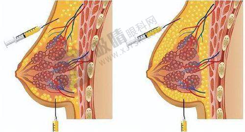 深圳瑞芙臣医疗美容门诊部开展项目