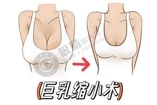 长沙哪家医院取奥美定最专业？5家清奥干净医院大揭秘