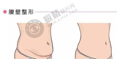 成都恒博植发靠谱吗？20年口碑医院+真实发际线种植效果分享