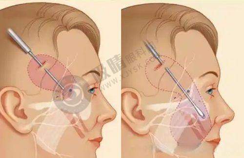 中南大学湘雅三医院整形科——长沙隆胸细腻操作与人性化服务的代表