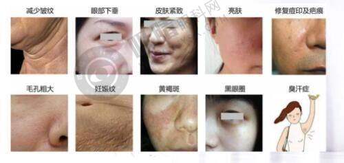 其他作用介绍:舒敏之星的多元美肤功效