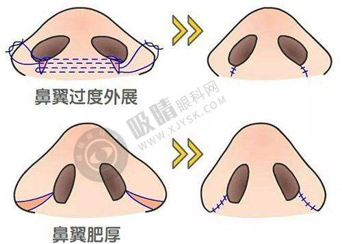 深圳瑞芙臣医疗美容门诊部医院优势