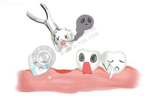 深圳爱康美口腔——宝安解决疑难种牙问题骨干医生