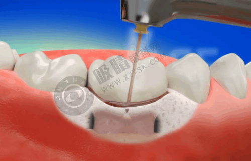 潍坊寿光华贝口腔门诊部收费情况