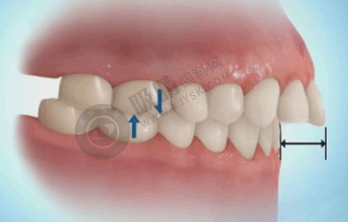 深圳同步齿科——宝安科学化连锁种牙机构