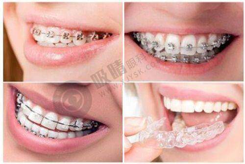 在太原鼎植口腔医院，如何定制你的牙齿矫正方案？