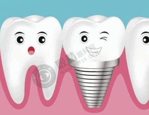 柳州蓝天口腔门诊部未详细展开内容