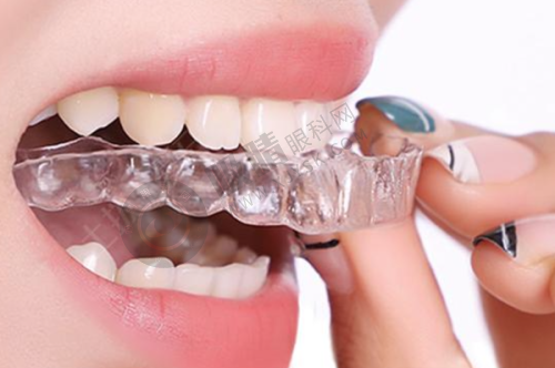 廊坊尤诺口腔门诊部种牙多少钱？进口种植体3980元起，医生20年经验保障！