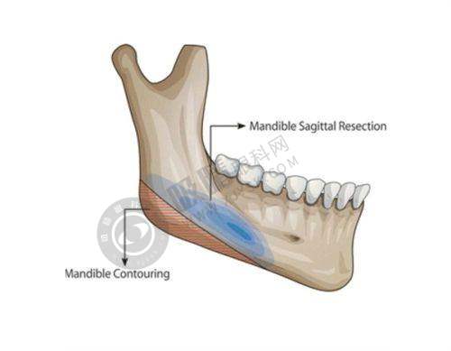 马秀云：魅惑上镜眼与眼周抗衰双眼皮骨干医生