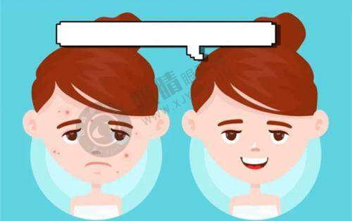 上海激光美容价格贵吗？2025新版价目表曝光，皮秒祛斑+热玛吉价格全解析