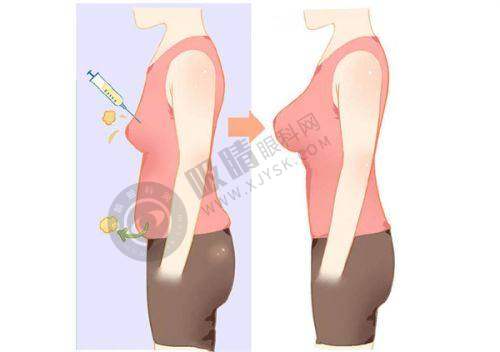 整形做双眼皮价格表