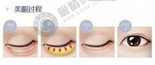 郑胜医生简介：重庆铜雀台专精与实力并存的面部除皱医生