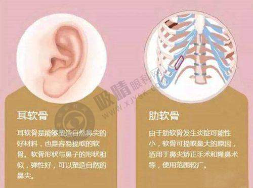 李成成：猫系漫画眼双眼皮创造者