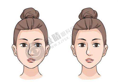 西南医院美容整形科靠谱吗？专业医生团队+真实隆鼻案例揭秘