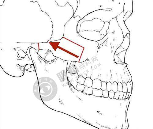 2025年打熊猫针避免花冤枉钱的坑