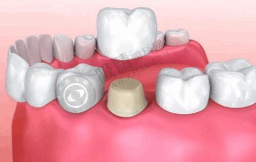 如何根据需求选择适合的广州市荔湾区做口腔十大医院2025榜单更新？