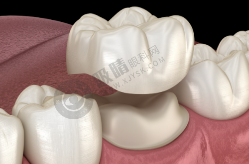 徐州博奥口腔——徐州良心牙科技术服务典范