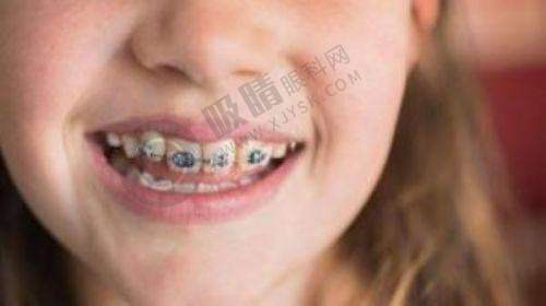 广西柳州蓝天口腔是否有种植牙资质及收费情况