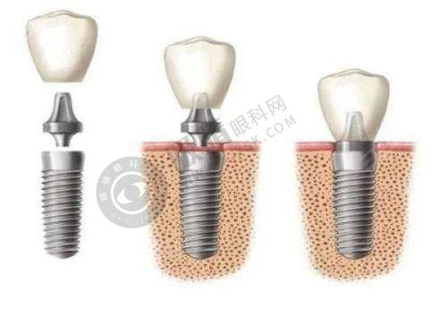 肖化云医生擅长诊疗项目