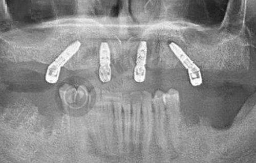 天津爱齿口腔医院(南开店)