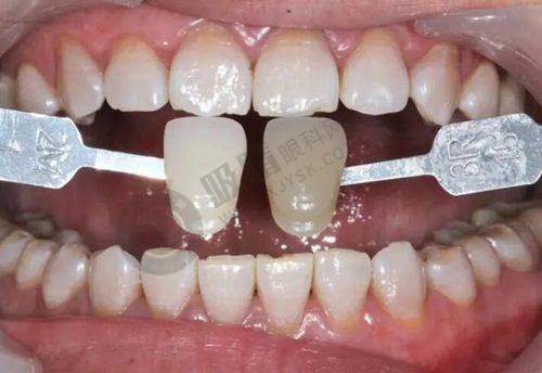 肖化云医生近期真实评价