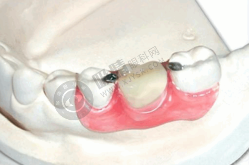 深圳正夫口腔医院真人实例