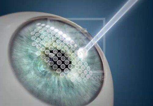 江门哪家眼科医院技术强？五邑爱尔新希望+市中心医院实力对比