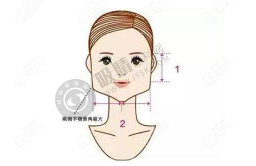 余文林唇裂修复:精细操作改善功能与美观