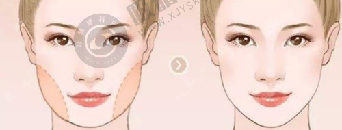 张建军 医生——仿生理双眼皮手术原理的创造者