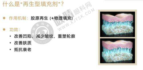 整形后的成效维持