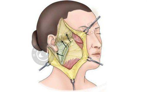 昆明悦格医疗美容门诊部——昆明精致整形的贴心之选