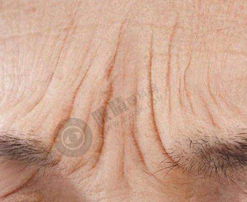 曹孟君医生深圳口碑情况测评