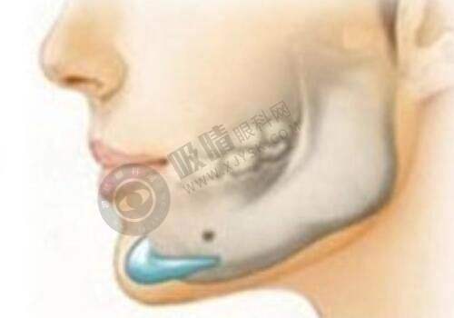 昆明艺星医疗美容医院——昆明特色整形的好去处