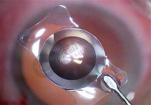 南宁爱尔眼科医院地址在哪里?兴宁区朝阳路63号,专业眼科诊疗项目齐全!