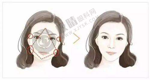 昆明华美美莱美容医院——昆明综合整形的实力之选