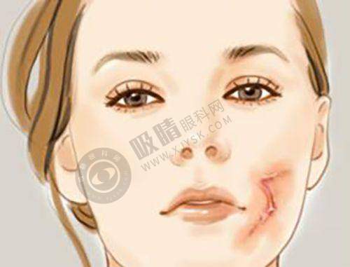 温州云美医疗美容门诊部正规吗?真实评价:14人持证上岗,眼部整形效果自然获好评!