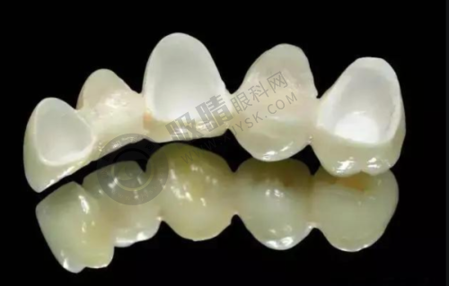 成都英博口腔种植牙靠谱吗?技术+医生+价格全解析!