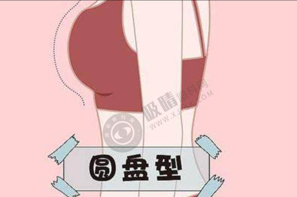 上海艺星整形医院丰胸怎么样？