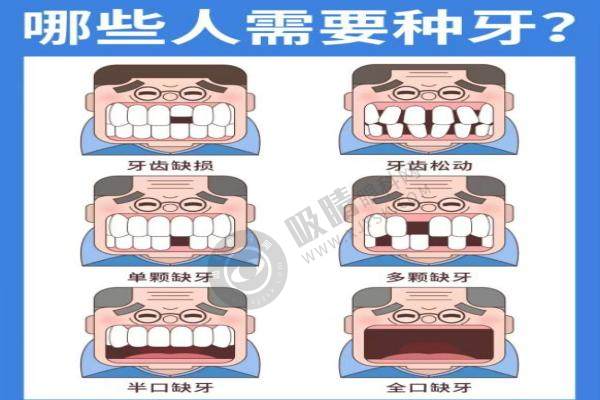赣州施美尔口腔种植牙.jpg