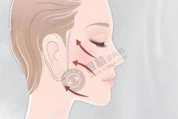 北京加减美面部提升.jpg