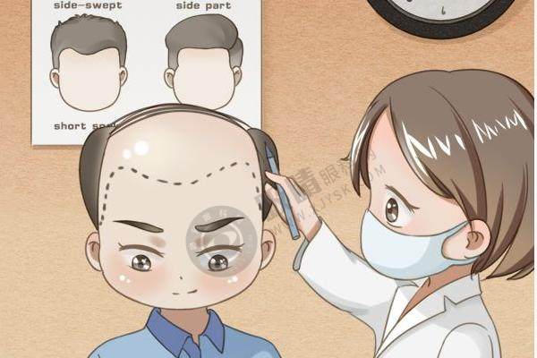 郑州 曙光植发 价格优惠