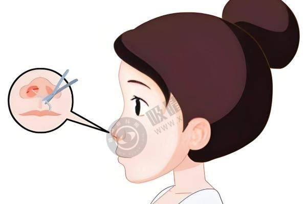 鹏爱 医疗美容 新客专享  