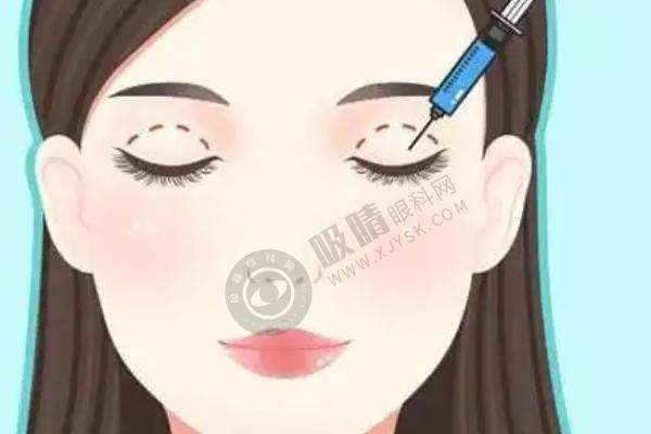 宜昌蕾蒂眼部整形